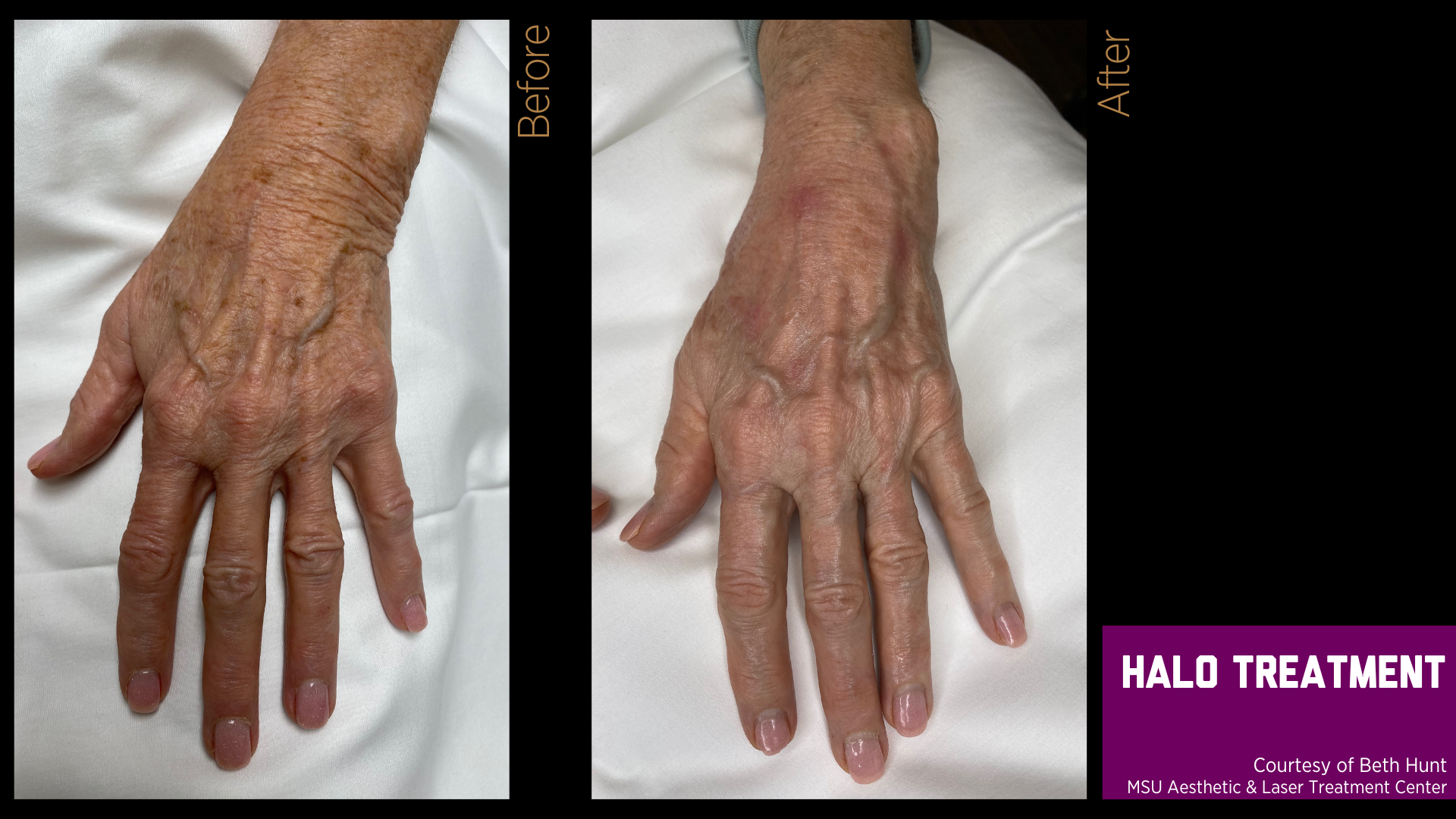 before and after treatment photos